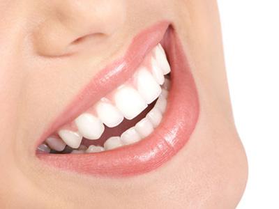 Yuk Ikuti 3 Cara Instan untuk Putihkan Gigi